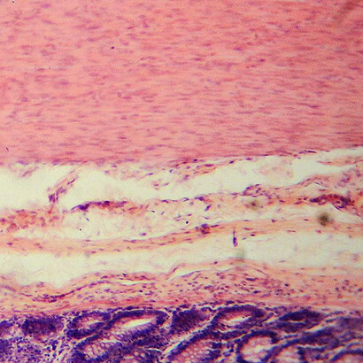 La mayoría de nuestras bacterias residen en el intestino y contienen unas 100 veces más ADN codificante de proteínas que nuestras células humanas