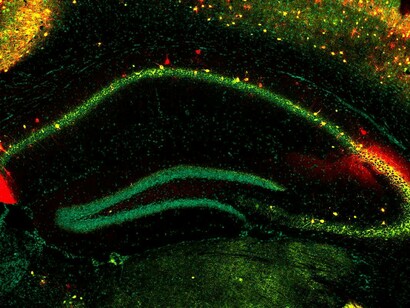 An image asking the question: how does the brain "know" where things are?