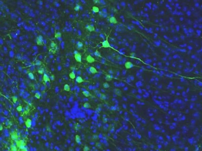 The clusters of information, arranged by the nucleons in the brain