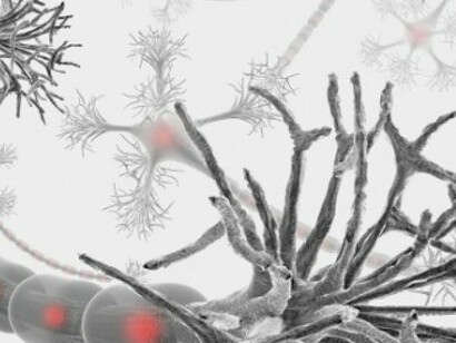Sistema nervioso afectado por esclerosis múltiple