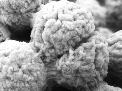 Algae observed under a Scanning Electron Microscope at 20,000x magnification