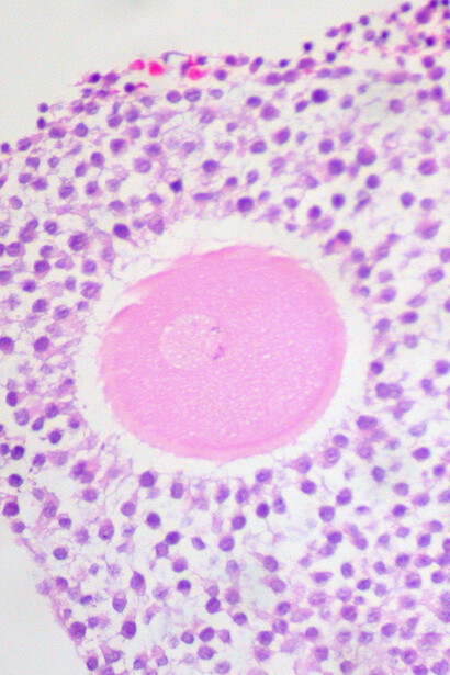 Ed Uthman, Ovum dans le Cumulus Oophorus, Ovaires humains, illustration liée à l'ovisme, 19 octobre 2011