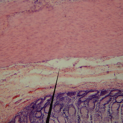 No solo tenemos neuronas en el cerebro, sino también en el intestino