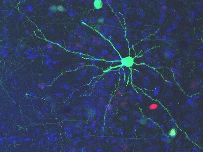 Neurological information flow