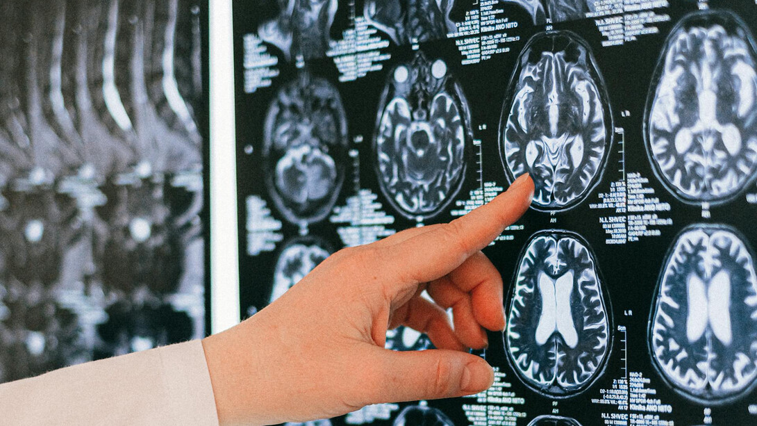 El sistema nervioso entérico y el microbioma intestinal ¡son tu segundo cerebro!