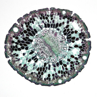 Las células de nuestra piel (epidermis) mueren y son reemplazadas cada 2 o 3 semanas