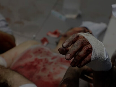 Since the beginning of the Israeli air strikes against the Palestinian people, many parts of the Gaza Strip have been destroyed and a large number of residents of the strip have been killed