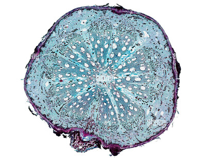 A close-up of a cell under a microscope