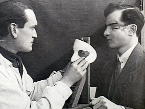 Primi interventi di chirurgia plastica