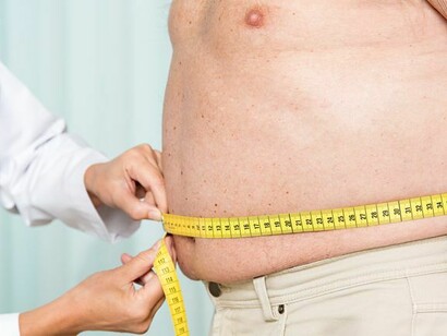 Obesity appears to be primarily a result of the rise of a society of mass consumption and of the fast food and agri-industry’s quest for bloated profits through processed foods