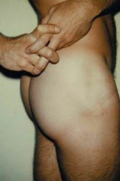 Warhol. Another photography of “Sex Parts”