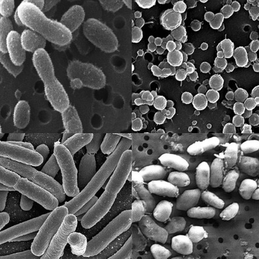 Some kind of bacteria, as detected by SEM micro-photography