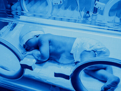 A newborn baby in a phototherapy incubator receiving treatment for neonatal jaundice to promote healthy skin and bilirubin levels