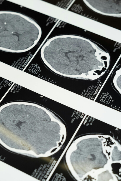 Psicólogo explora a relação entre padrões respiratórios e desempenho cognitivo, destacando os benefícios para tarefas diárias
