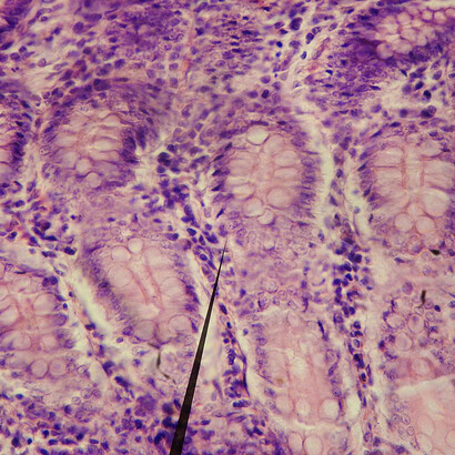 Nuestro microbioma intestinal afecta a nuestro comportamiento, salud, inteligencia y emociones