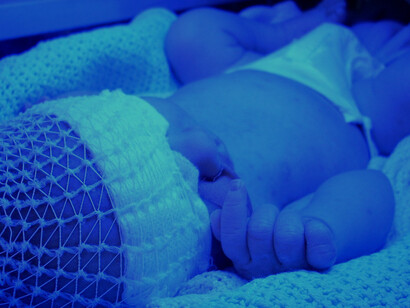 A newborn infant undergoing phototherapy in an incubator to effectively treat neonatal jaundice and ensure healthy bilirubin levels
