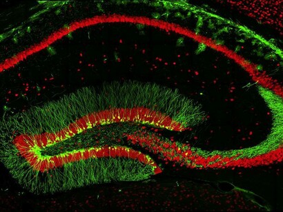 Information processing in the brain