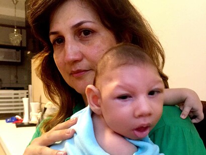Una madre con su bebé, afectado por el virus zica