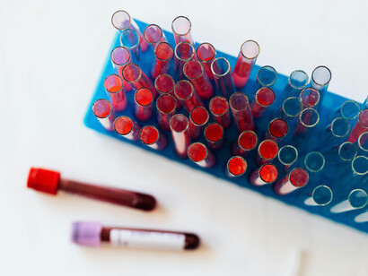 A set of full vials of blood samples in test tubes