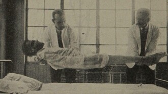Un caso straordinario di rigidità catatonica. Sostenuto solo dalle spalle e dai piedi, il corpo è completamente sospeso a mezz'aria, 1915