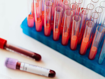 Assorted equipment for analyzing blood