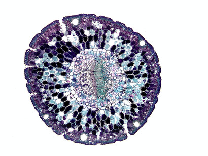 A cell is seen under a microscope