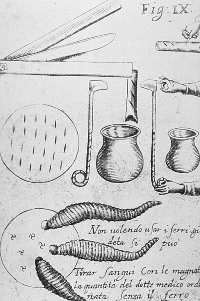 Antichi strumenti di medicina