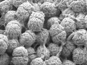 Scanning Electron Microscope Image of Algae at 5000x Magnification