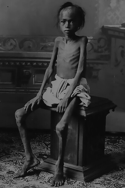 In the harrowing context of a famine in India, a young boy emerges as a poignant symbol of the devastating impact, illustrating the urgent need for humanitarian aid to address food insecurity