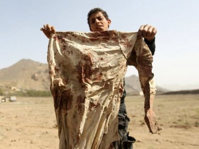 Los conflictos en Yemen se han cobrado muchas vidas