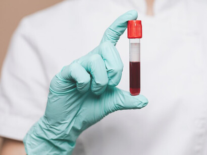 Expert doctor wearing a medical mask is depicted holding a syringe and vacutainers, symbolizing the precision and care involved in medical procedures for accurate diagnosis and treatment