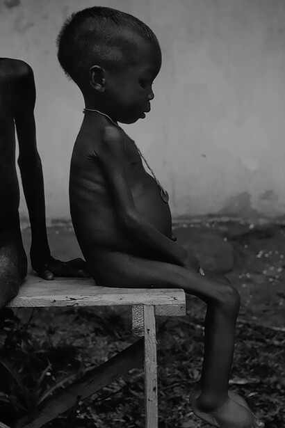 During the Nigerian-Biafran War in the late 1960s, a haunting image emerges of a starved girl, a poignant symbol of the tragic humanitarian crisis and the devastating impact of conflict on innocent lives