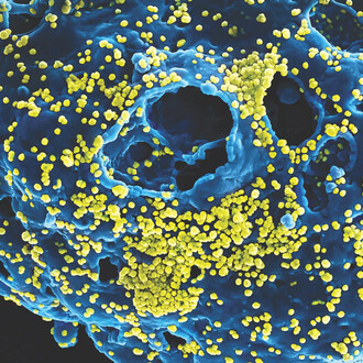Outbreak: Epidemics in a Connected World. Courtesy of Smithsonian's National Museum of Natural History