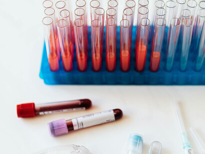 Full vials of blood among different equipment for taking blood samples