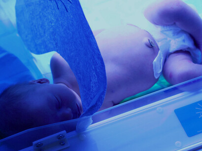 A baby in an incubator receiving targeted phototherapy for neonatal jaundice, promoting optimal skin health and bilirubin reduction