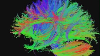 Conectoma: mapa detallado y exhaustivo de todas las conexiones neuronales que existen en un un cerebro