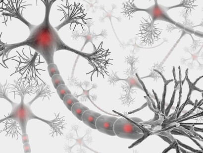 Sistema nervioso afectado por la esclerosis múltiple