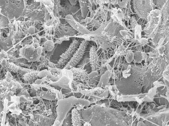 Algae and bacteria imaged under a Scanning Electron Microscope at 5000x magnification