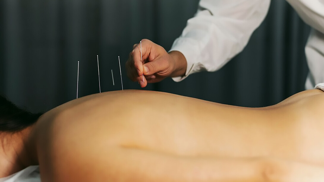Experience the healing power of acupuncture with a skilled Chinese medicine practitioner providing traditional treatment