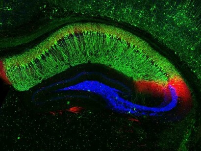 Patterns of signals recorded in the brain