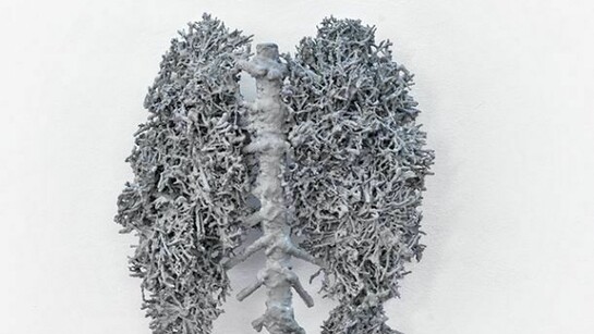 Paolo Grassino, S.T. 2008, Fusioni, alluminio, 81 x 64 x 37cm