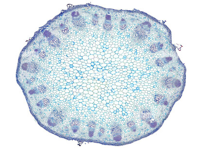 A close-up of a cell under a microscope